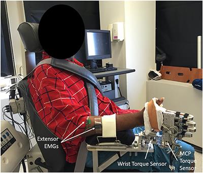 Passive Properties of the Wrist and Fingers Following Chronic Hemiparetic Stroke: Interlimb Comparisons in Persons With and Without a Clinical Treatment History That Includes Botulinum Neurotoxin